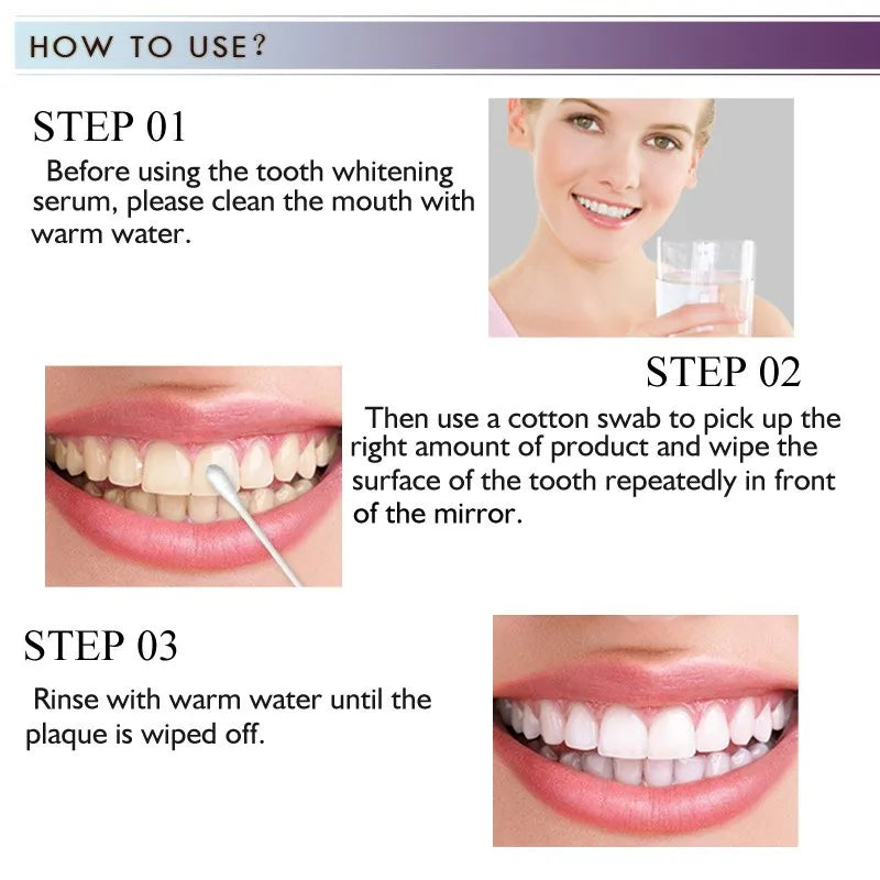 TEETH WHITENING ESSENCE RtopR