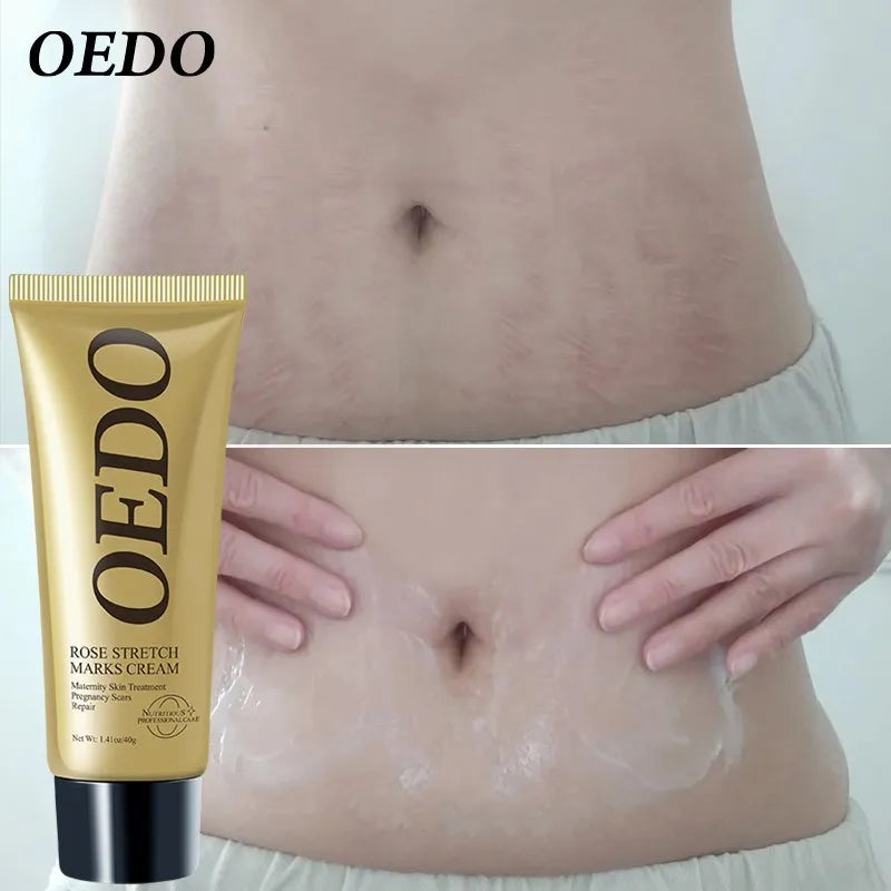 ROSE STRETCH MARK CREAM OEDO